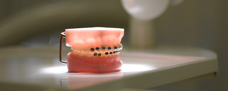 Orthodontics Dentistry