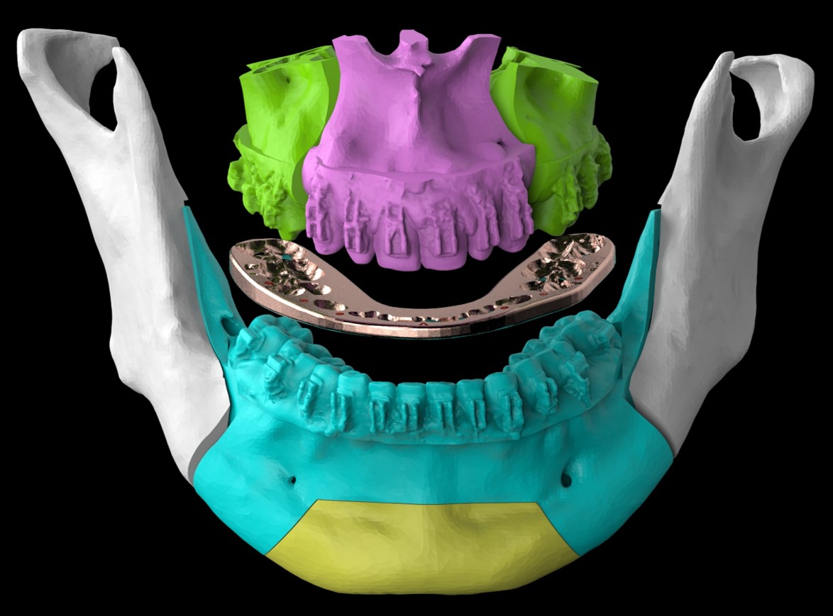 3D jaw scan